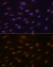 Anti-MyoD1 antibody used in Immunocytochemistry/ Immunofluorescence (ICC/IF). GTX65875