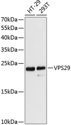 Anti-VPS29 antibody used in Western Blot (WB). GTX65880