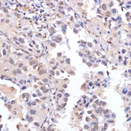 Anti-LRDD antibody used in IHC (Paraffin sections) (IHC-P). GTX65888