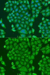 Anti-CENPK antibody used in Immunocytochemistry/ Immunofluorescence (ICC/IF). GTX65896