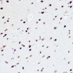 Anti-PRP8 antibody used in IHC (Paraffin sections) (IHC-P). GTX65909