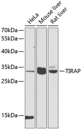 Anti-TIRAP antibody used in Western Blot (WB). GTX65910