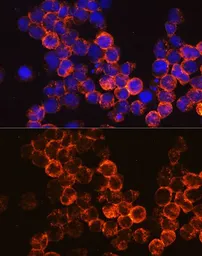Anti-CD45 antibody used in Immunocytochemistry/ Immunofluorescence (ICC/IF). GTX65913