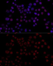 Anti-hnRNP L antibody used in Immunocytochemistry/ Immunofluorescence (ICC/IF). GTX65923