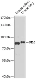 Anti-IFI16 antibody used in Western Blot (WB). GTX65937