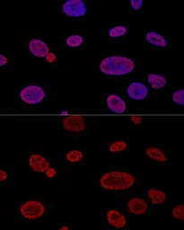 Anti-ALY antibody used in Immunocytochemistry/ Immunofluorescence (ICC/IF). GTX65947