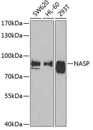 Anti-NASP antibody used in Western Blot (WB). GTX65952