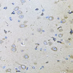 Anti-MEMO1 antibody used in IHC (Paraffin sections) (IHC-P). GTX65986