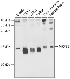 Anti-MRPS6 antibody used in Western Blot (WB). GTX65992