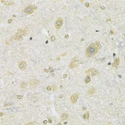 Anti-SLC2A13 antibody used in IHC (Paraffin sections) (IHC-P). GTX65995
