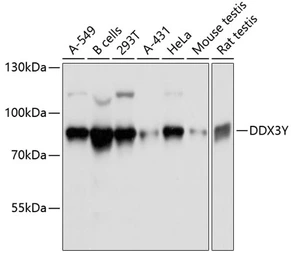 Anti-DDX3Y antibody used in Western Blot (WB). GTX66004