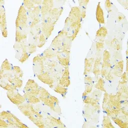 Anti-DDX3Y antibody used in IHC (Paraffin sections) (IHC-P). GTX66004