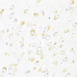 Anti-DDX3Y antibody used in IHC (Paraffin sections) (IHC-P). GTX66004