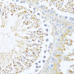 Anti-DDX3Y antibody used in IHC (Paraffin sections) (IHC-P). GTX66004
