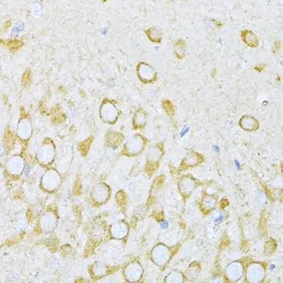 Anti-Valyl tRNA synthetase antibody used in IHC (Paraffin sections) (IHC-P). GTX66016