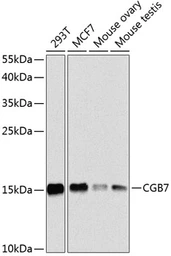 Anti-hCG beta 7 antibody used in Western Blot (WB). GTX66027