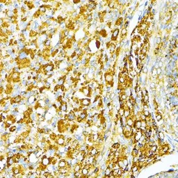 Anti-VAMP1 antibody used in IHC (Paraffin sections) (IHC-P). GTX66029