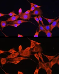 Anti-AMT antibody used in Immunocytochemistry/ Immunofluorescence (ICC/IF). GTX66030