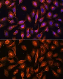 Anti-alpha Fodrin antibody used in Immunocytochemistry/ Immunofluorescence (ICC/IF). GTX66033