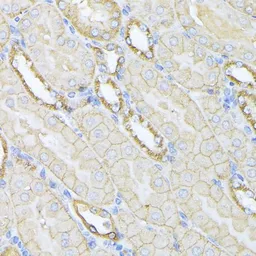 Anti-alpha Fodrin antibody used in IHC (Paraffin sections) (IHC-P). GTX66033