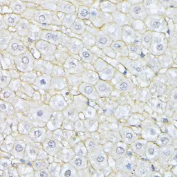 Anti-alpha Fodrin antibody used in IHC (Paraffin sections) (IHC-P). GTX66033