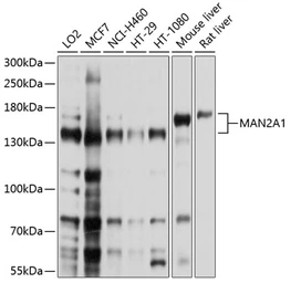 Anti-MAN2A1 antibody used in Western Blot (WB). GTX66054