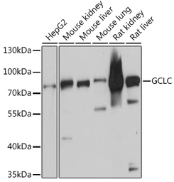 Anti-GCLC antibody used in Western Blot (WB). GTX66057