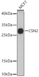 Anti-beta Casein antibody used in Western Blot (WB). GTX66115