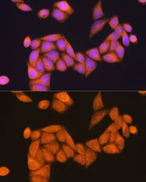 Anti-RAP1B antibody used in Immunocytochemistry/ Immunofluorescence (ICC/IF). GTX66139