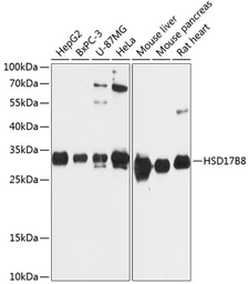 Anti-HSD17B8 antibody used in Western Blot (WB). GTX66143