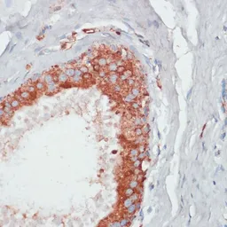 Anti-PGK2 antibody used in IHC (Paraffin sections) (IHC-P). GTX66145