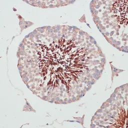 Anti-PGK2 antibody used in IHC (Paraffin sections) (IHC-P). GTX66145