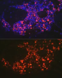 Anti-Neutrophil elastase antibody used in IHC (Paraffin sections) (IHC-P). GTX66150