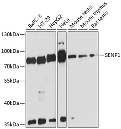 Anti-SENP1 antibody used in Western Blot (WB). GTX66159