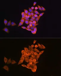 Anti-RRM1 antibody used in Immunocytochemistry/ Immunofluorescence (ICC/IF). GTX66190