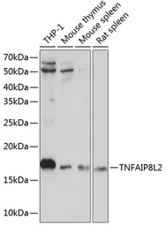 Anti-TNFAIP8L2 antibody used in Western Blot (WB). GTX66198