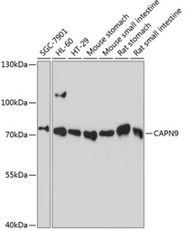 Anti-Calpain 9 antibody used in Western Blot (WB). GTX66207