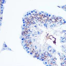 Anti-Serotonin Transporter antibody used in IHC (Paraffin sections) (IHC-P). GTX66232