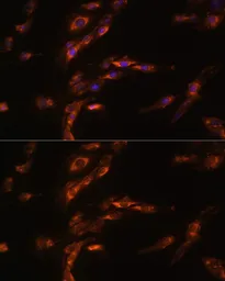 Anti-GABA A Receptor gamma 1 antibody used in Immunocytochemistry/ Immunofluorescence (ICC/IF). GTX66238