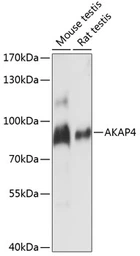Anti-AKAP 82 antibody used in Western Blot (WB). GTX66294