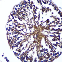 Anti-Bif-1 antibody used in IHC (Paraffin sections) (IHC-P). GTX66305