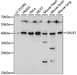 Anti-GALK1 antibody used in Western Blot (WB). GTX66350