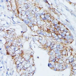 Anti-MANBA antibody used in IHC (Paraffin sections) (IHC-P). GTX66354