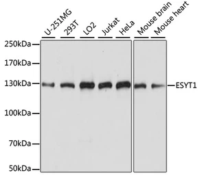 Anti-FAM62A antibody used in Western Blot (WB). GTX66375