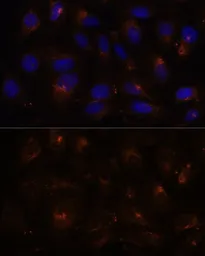 Anti-FAM62A antibody used in Immunocytochemistry/ Immunofluorescence (ICC/IF). GTX66375