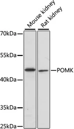 Anti-SGK196 antibody used in Western Blot (WB). GTX66392