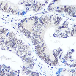 Anti-SNRPB antibody used in IHC (Paraffin sections) (IHC-P). GTX66411