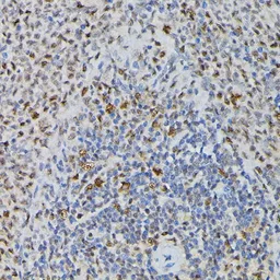 Anti-PRPF4 antibody used in IHC (Paraffin sections) (IHC-P). GTX66476