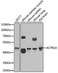 Anti-ACTR1A antibody used in Western Blot (WB). GTX66477