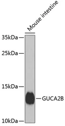 Anti-GUCA2B antibody used in Western Blot (WB). GTX66518